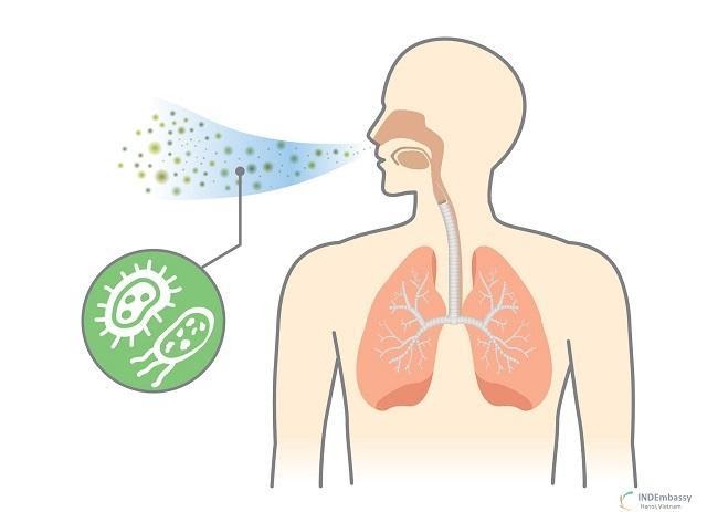 Viêm phổi là gì, chữa được không? Triệu chứng, nguyên nhân và điều trị - Chi tiết tin tức